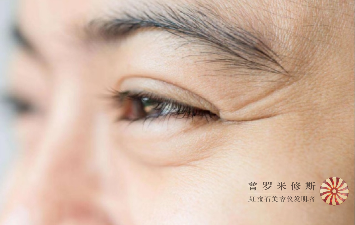 烙鐵們，你的魚尾紋真的需要熨一下！