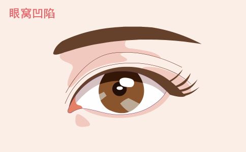 打造無痕肌膚，選擇激光祛痘印就是關鍵！