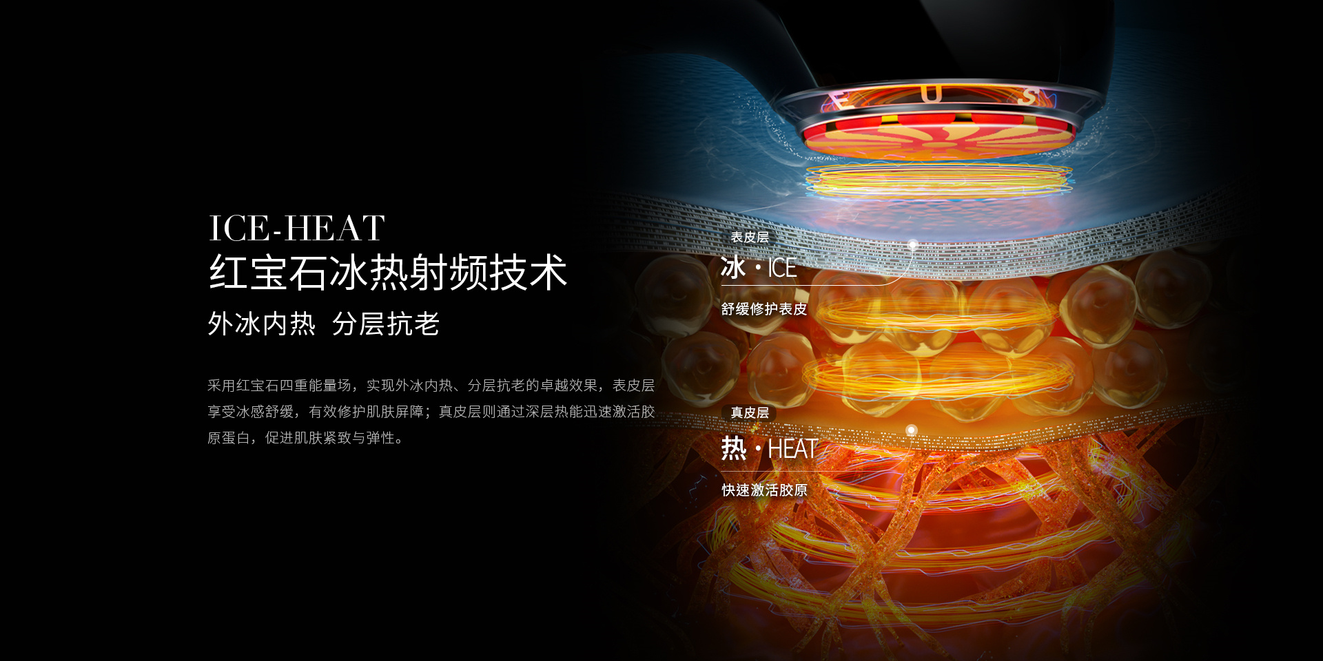 ICE-HEAT紅寶石冰熱射頻技術